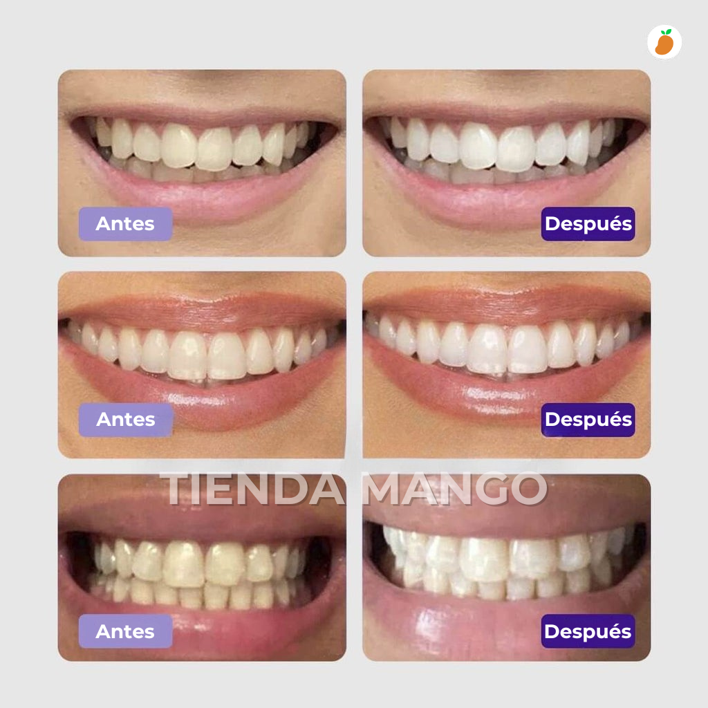 Blanqueamiento Dental Premium - Sérum V34™ + Regalo (Últimas Unidades)